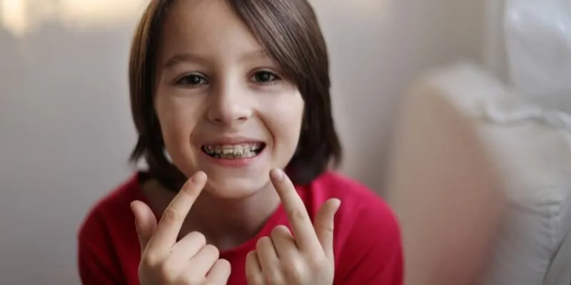 Niềng răng cho trẻ em